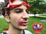 169_953162788_herpes_H213053_L.jpg